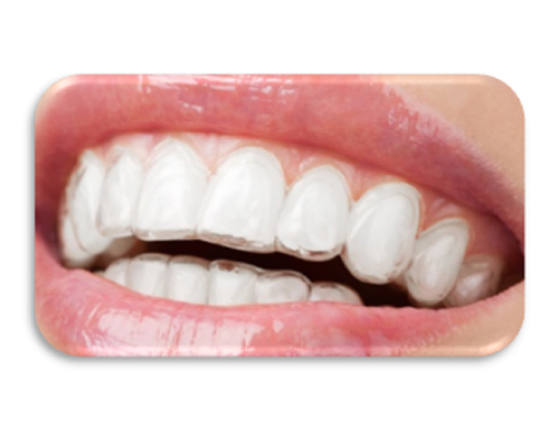 Invisalign Aligners For Adult